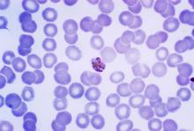 Mature_Plasmodium_malariae_schizont_PHIL_2715_lores.jpg